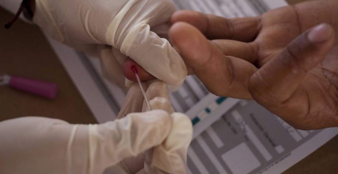 Confirman la remisión del VIH de un segundo paciente tras un trasplante de médula